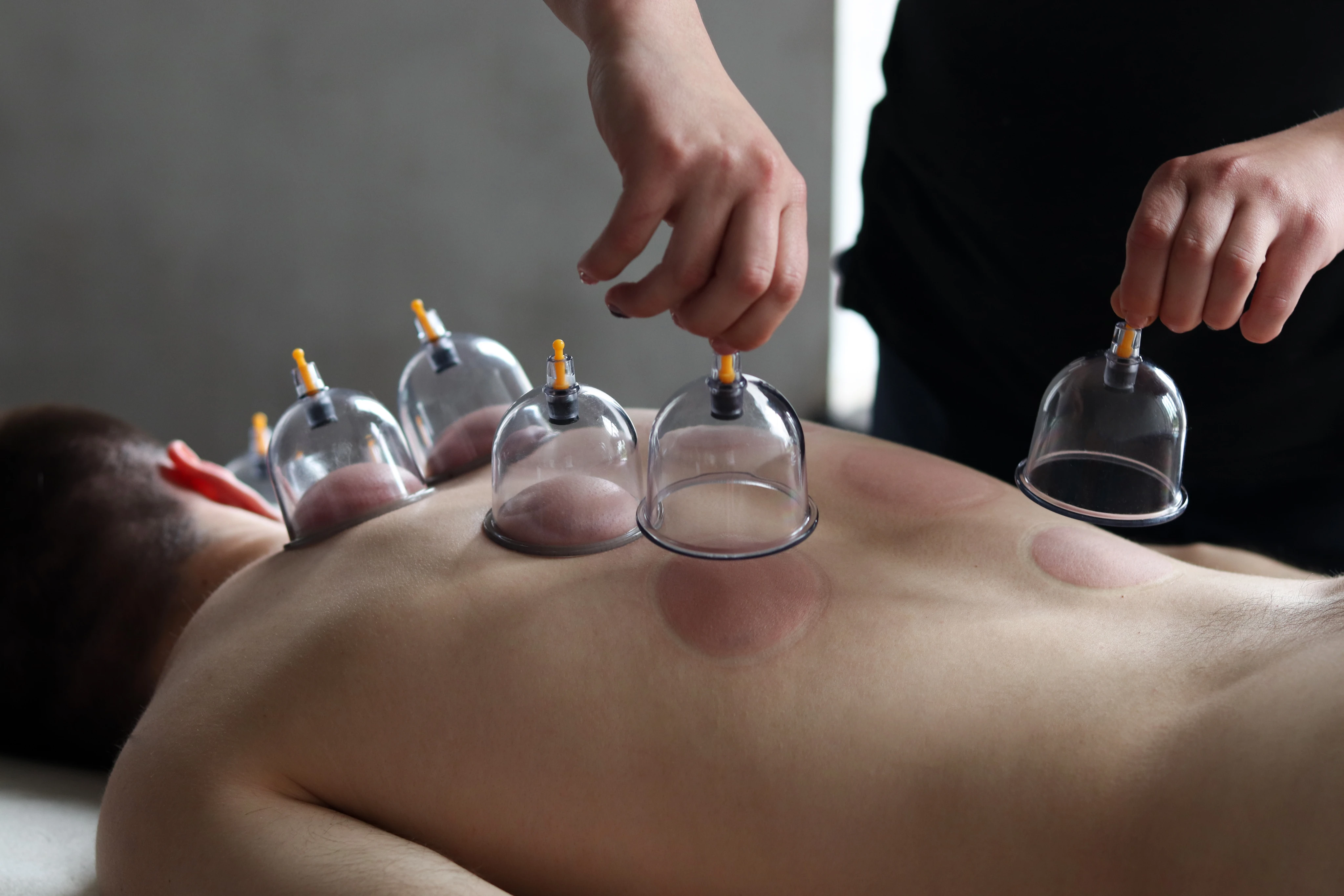 Massage & Cupping